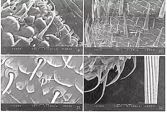美洲大蠊触角扫描电镜观察：左上图：st1，毛形感受器（sensilla&nbsp;trichodea，type1）；右上图：sc1，刺形感受器（sensilla&nbsp;chaetica，type1）；左下图：sb1，锥形感受器（sensilla&nbsp;basiconca，type1）。在果蝇研究中曾报道，离子型谷氨酸受体在触角的锥形感受器中被表达，以此调节对挥发性化学线索和温度的响应。&nbsp;（图片来源：参考文献[9]）
