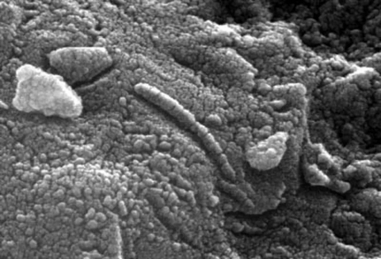 　火星陨石中类似微生物的结构&nbsp;/&nbsp;ESA