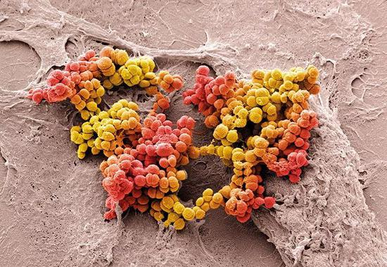 在人类皮肤中发现了金黄色葡萄球菌Staphylococcus aureus（图中红色和黄色）。