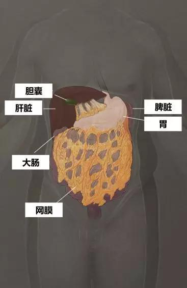 网膜解剖图示。网膜是身体腹部脂肪的主要聚集部位。它包裹着腹部器官，像围裙一样悬挂着。这种脂肪组织起着重要的免疫作用，但也是肥胖症患者慢性炎症的来源，可能导致代谢综合征。 网膜也是卵巢癌转移的常见部位。&nbsp;制图：CATHERINE DELPHIA