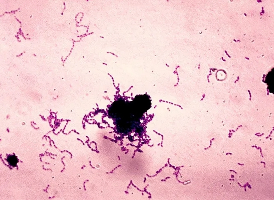变形链球菌丨Wikimedia Commons，&nbsp;&nbsp;Centers for Disease Control and Prevention‘s&nbsp;Public Health Image Library&nbsp;/ Public domain