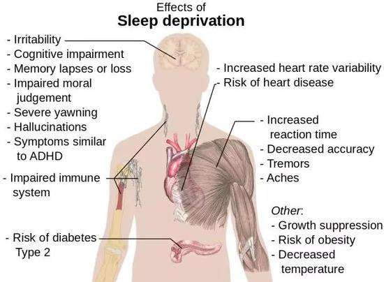 睡眠不足对健康的影响 图源：Wikipedia