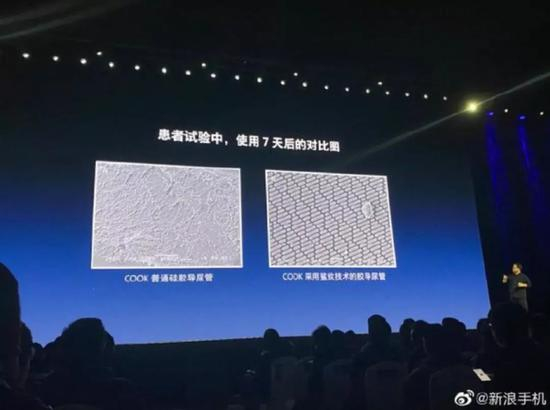 普通导尿管和采用鲨纹技术的导尿管，在使用 7 天后的表面对比图，图片来源：新浪手机