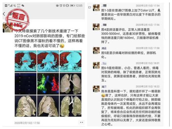  ▲网传新冠肺炎患者的肺部会被病毒啃噬，出现很恐怖的情况（图片来自微博）