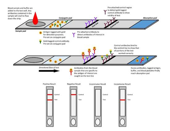 　　图3。 RDT流程图。来源：https：//www.centerforhealthsecurity.org/resources/COVID-19/serology/Serology-based-tests-for-COVID-19.html