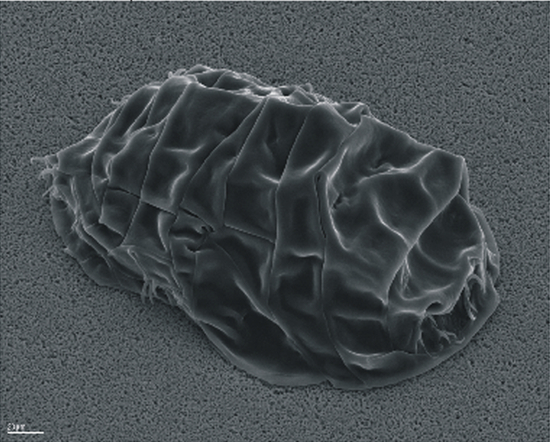 　　脱水后的水熊虫（图片来源：Schokraie E， Warnken U， Hotz-Wagenblatt A， Grohme MA， Hengherr S， et al。 （2012））