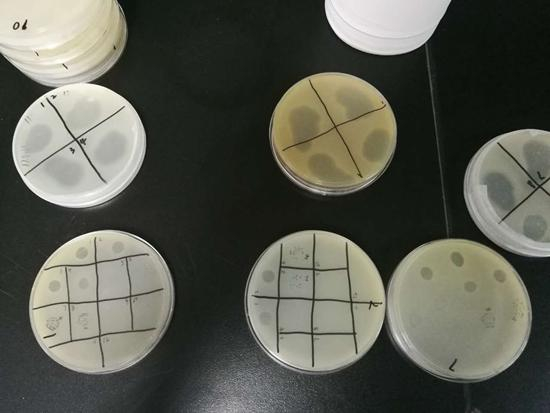 中科院武汉病毒研究所实验室中的噬菌体培养皿