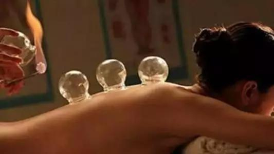 古代医家多用燃烧火力排气拔罐，在治疗疮疡脓肿时用它来吸血排脓，后来又扩大应用于肺痨、风湿等内科疾病。