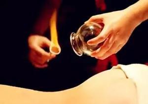 对于拔罐的研究和刮痧一样，多停留于对临床现象的观察研究，对其具体作用机制研究深度还远远不够。