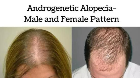 图源：Revital Trichology