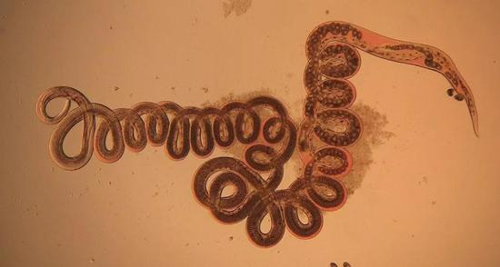 小林姬鼠体内取出的寄生蠕虫