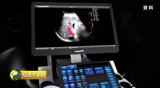 彩色B超设备