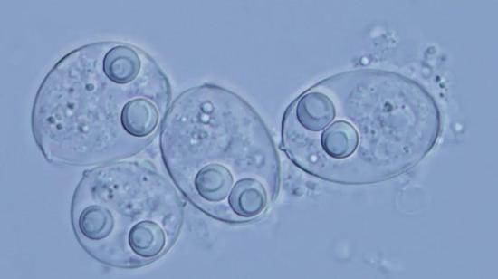  粘孢子虫（图片来源：Ivan Fiala）