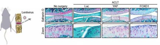 基于人干细胞“年轻因子”YAP和FOXD1的骨关节炎基因疗法