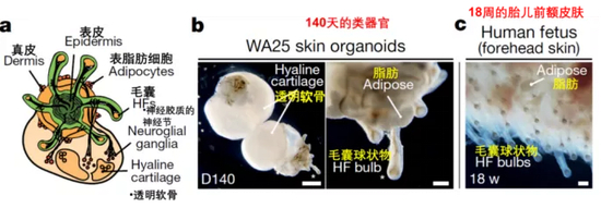  图片来源：参考文献1