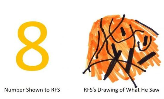左边是展示给病患的数字“8”，右侧是病患根据“8”画出的图形
