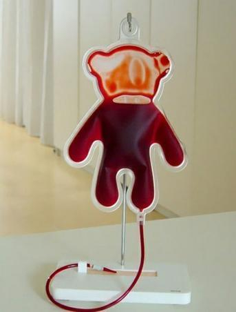 输血（网络图）