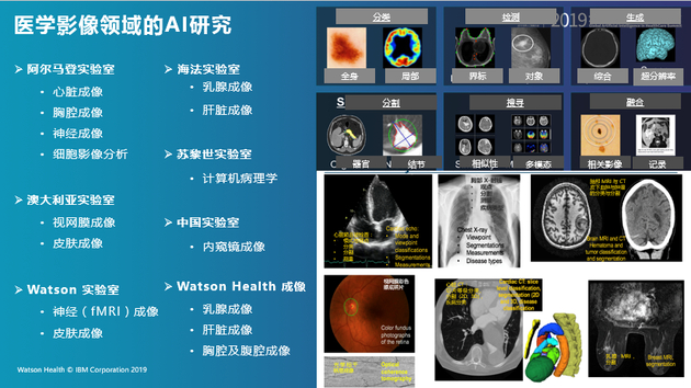 Watson Health医学影像领域的AI研究