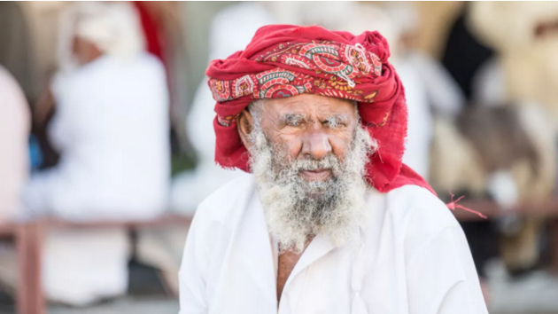 　　相比之下，老年女性的头发以及眉毛，却随着年龄的增长而日趋稀疏，那么，为什么男性的各种面部毛发在进入中老期会变得更加茂密，而女性则不会呢？