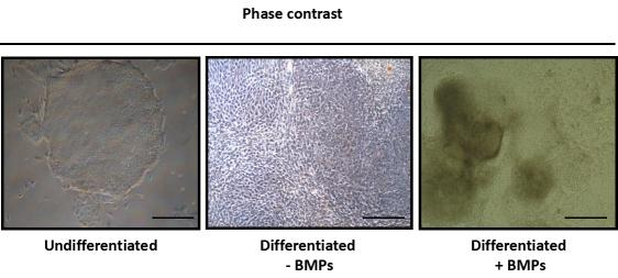 BMPs可诱导人类干细胞的分化