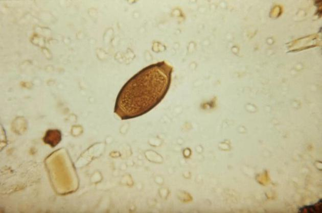 图中是一个人类鞭虫卵，目前德国一家公司希望出售猪肉鞭虫卵作为食物配料。