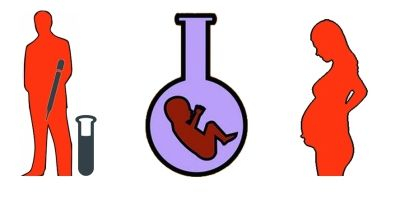 　　对于遗体取精，罗特曼提出了三种方案：一是注射一种能够让整个身体抽搐的药物，从而引起遗体射精；二是切除男性生殖器官，并从中寻找精子；三是手动刺激射精。