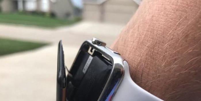 苹果再遇集体诉讼 这回是因为Apple Watch电池