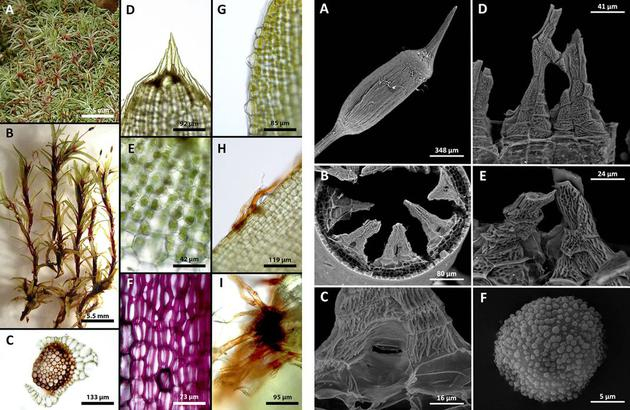 图为萨拉扎•艾伦最近发现的地衣新品种Octoblepharum peristomiruptum。她在去年十月发表在期刊《Phytokeys》上的论文中介绍了这一品种。