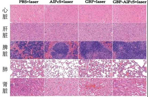 来自实验小鼠的主要器官的染色图像（图片来源：论文）