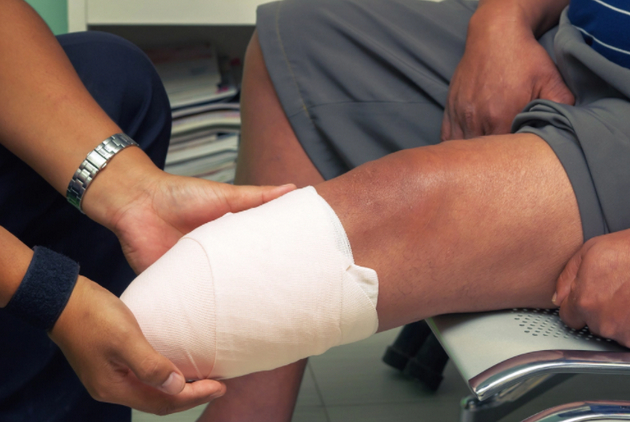 幻肢问题困扰着许多截肢者