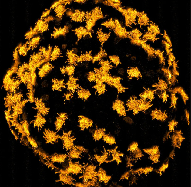 由塔夫茨大学的科学家制造的活体机器人具有独特的身体特征，如毛发状的纤毛，可以帮助它们移动。