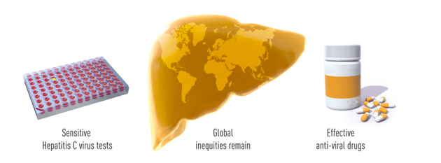 图3： 三位诺贝尔奖获得者的发现，使得研究者可以设计高灵敏度的血液测试来检测病毒，从而在世界上大部分地区消除输血性肝炎的传播风险。这一突破也使后人得以开发足以治愈该疾病的抗病毒药物。现在，丙型肝炎仍然是一个全球主要的健康问题，但是现在，我们有了消除这种疾病的机会。
