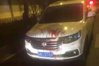 滴滴司机匕首伤乘客起因陷罗生门 滴滴逻辑能走多远?