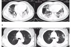 确诊数、死亡数等数据说明了什么？