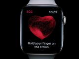 研究显示，苹果Apple Watch可帮助发现另一种危及生命的心脏疾病