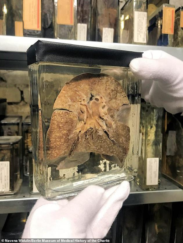 　　1、麻疹病毒出现的时间，大致与欧亚大陆、南亚和东亚地区开始出现大型城市中心的时间一致，该发现是基于1912年柏林一位患者肺组织提取的麻疹基因组分析获得的。