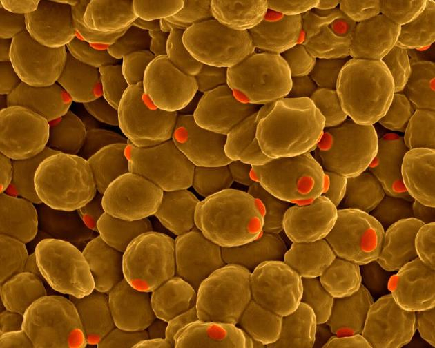 　　面包酵母的彩色电子显微镜图片。研究人员已经合成了酵母16条染色体中的6条，并计划在2018年底全部合成全部的染色体。