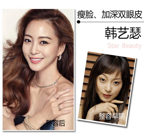 早期的韩艺瑟真的很像是韩剧里的恶毒女二