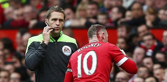 鲁尼头部血流不止