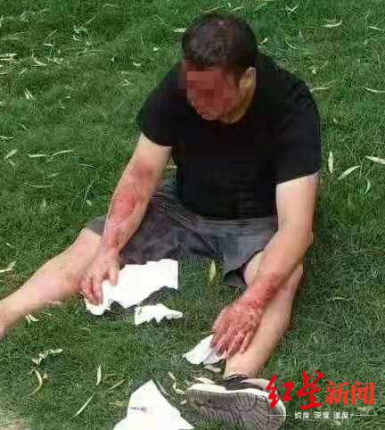  ↑被打后的王某