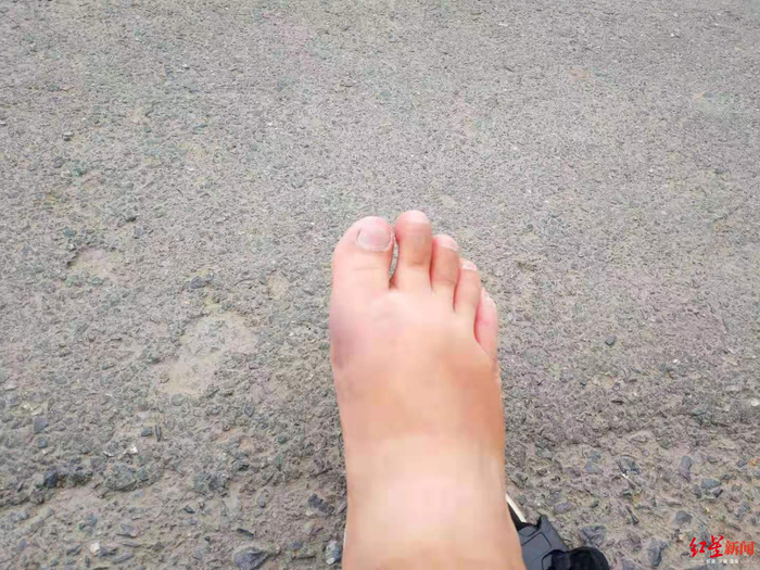  ↑脚部被撞