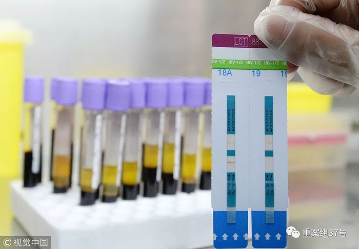 　2018年11月30日，河北省邯郸市疾病预防控制中心艾滋病确认实验室内，实验人员使用HIV抗体的快速试剂进行检测。图片来源/视觉中国