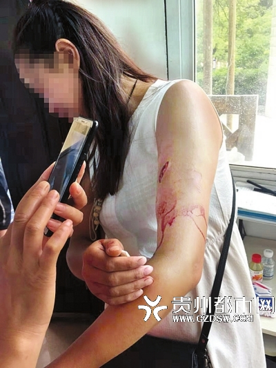一名女游客被猕猴咬伤左手，疼得直哭。 资料图