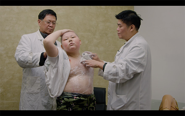 　　小胖第一次去假肢厂，他知道装了假肢，自己就可以像正常人一样回学校念书了。文中图片除特殊标注外，均为《人间世》摄制组提供。