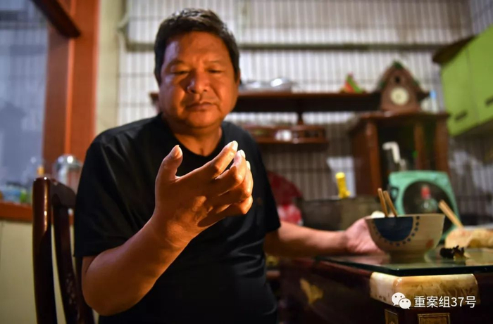 ▲吉兰-巴雷（格林巴利）综合症患者赵书新出现明显的“鸡爪手”症。新京报记者 李木易 摄