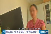 女子使用蒸汽眼罩患上结膜炎 专家:网红产品慎用