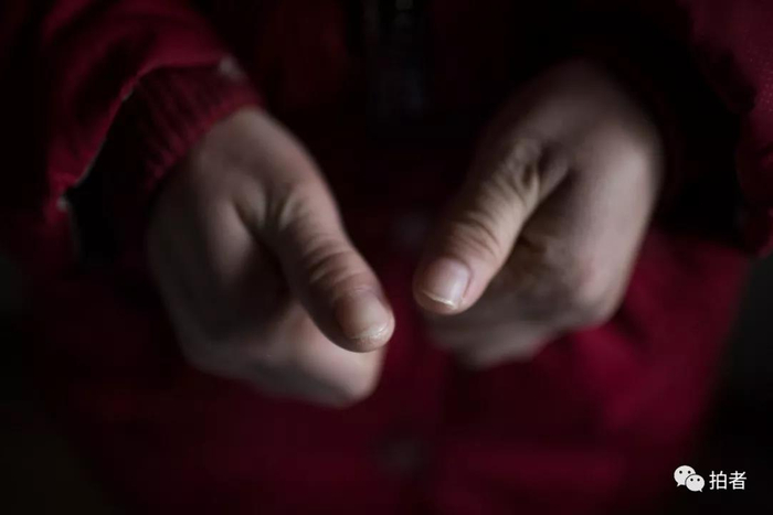  △&nbsp;36岁的杨希在此前的十八年中，一直过着艰难的生活。为了谋生，杨希学会了推拿，长期的推拿工作，让她的手已经有点变形。如今，她最大的愿望是希望自己的非婚生女儿能上户口。