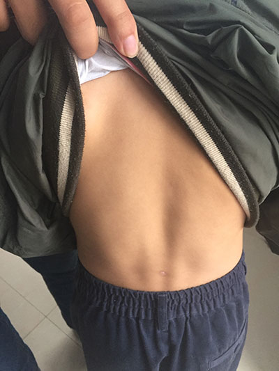 　　9月30日，记者前往安徽省来安县小毛亲生父母的家，见到孩子本人。目前，孩子身上的伤已经痊愈。章正/摄