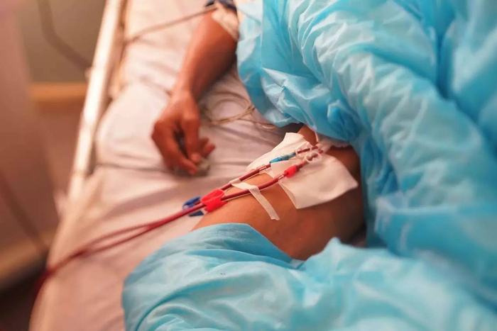 百草枯中毒病人做血液灌流 摄影：vict