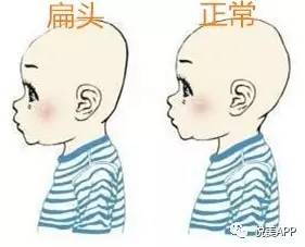 头扁脸就大,还影响智商...这都是中国父母故意压扁的!愚昧啊!_手机新浪网